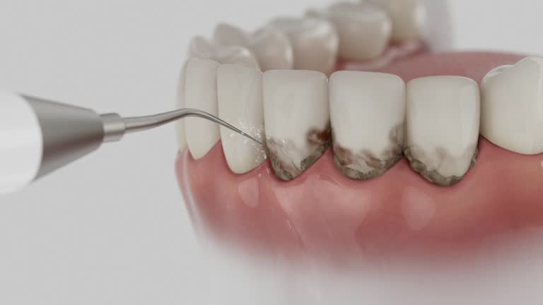Trusted Invisalign Clear Aligners service in Lake Camelot, IL - Dentist Open Now